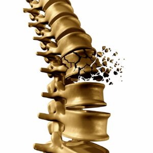 Car Accident Spinal Cord Injuries