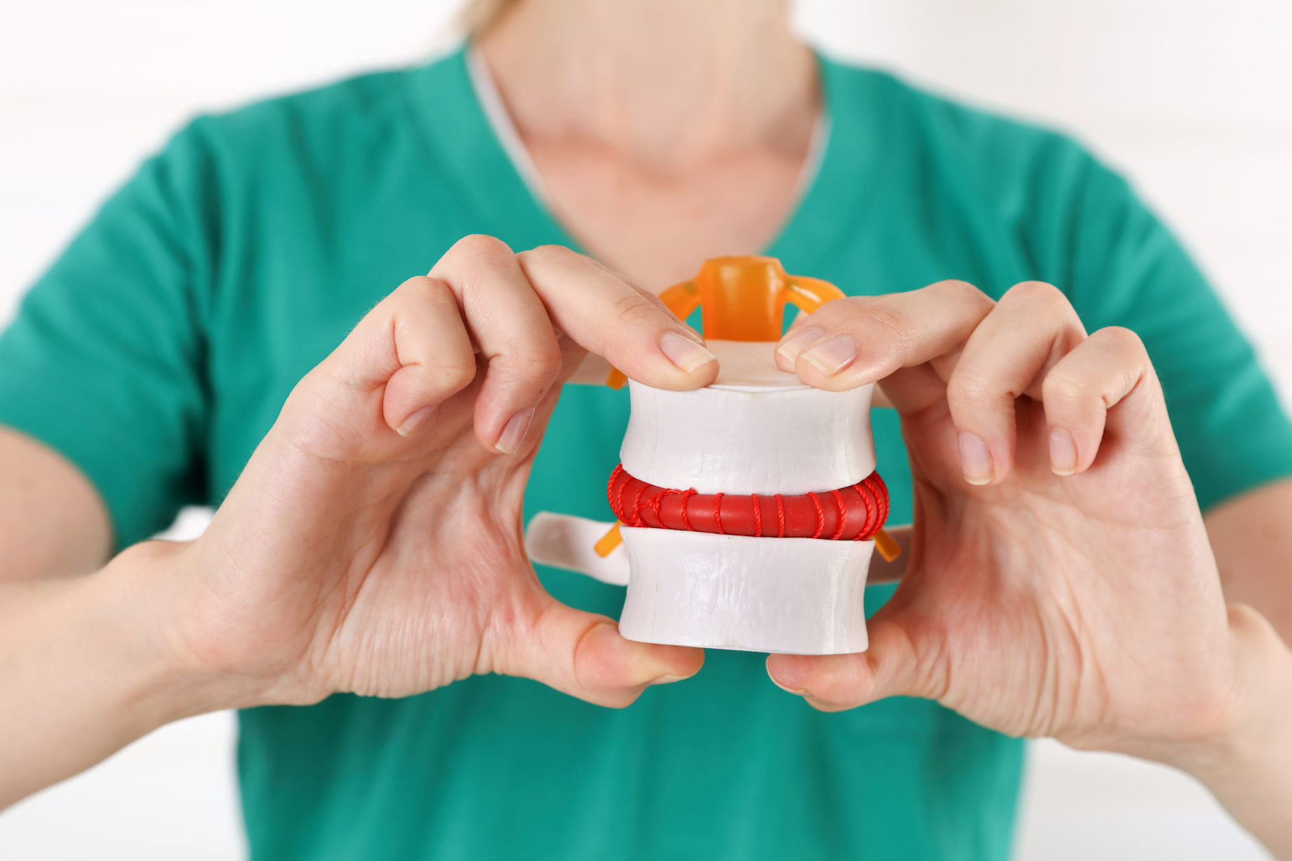 A woman in a nurse uniform holding up a vertebrae model. Depicts a slipped disk and pinched nerve